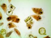 Phytoplancton et zooplancton. En vert, des diatomées, algues microscopiques